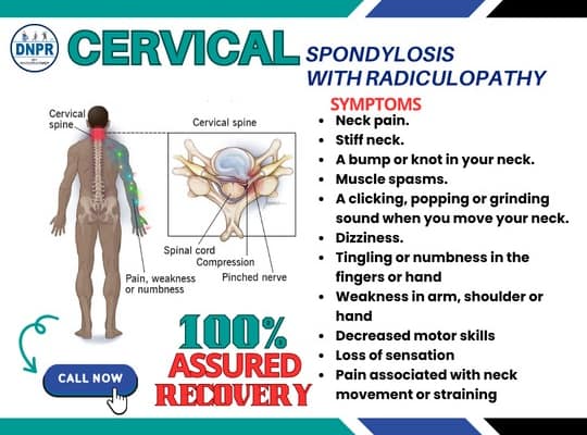 Physiotherapy for Cervical Spondylosis